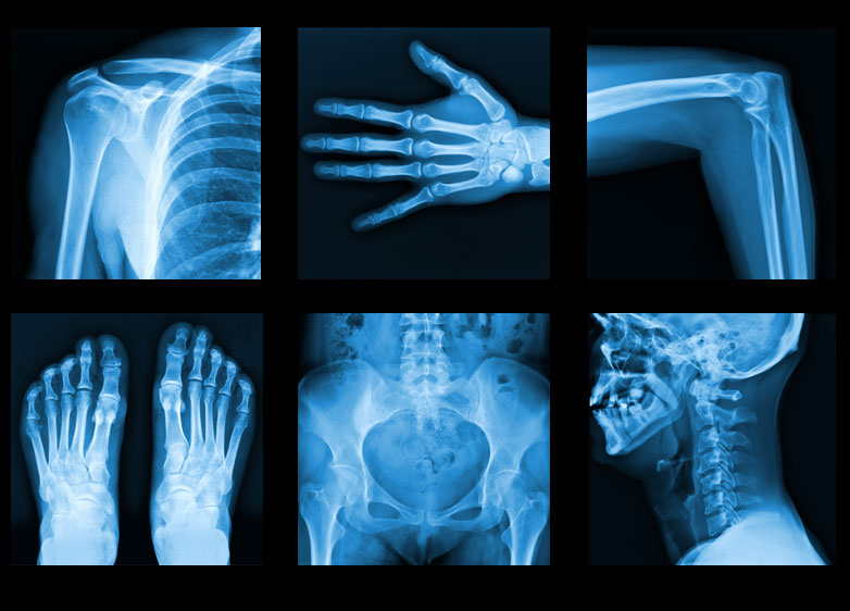 X-Ray Houston | Diagnostic Imaging Humble TX